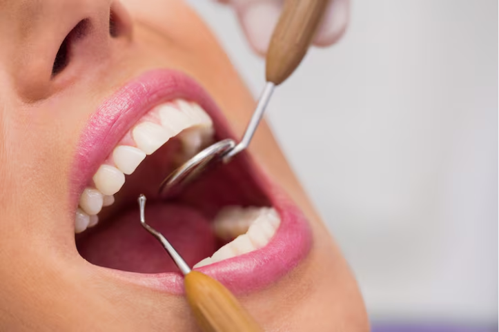 Can Fewer Dental Implants Replace Several Missing Teeth? 